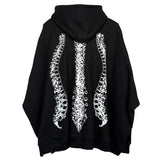 surgery spine over hood T 'black' (6639985033334)